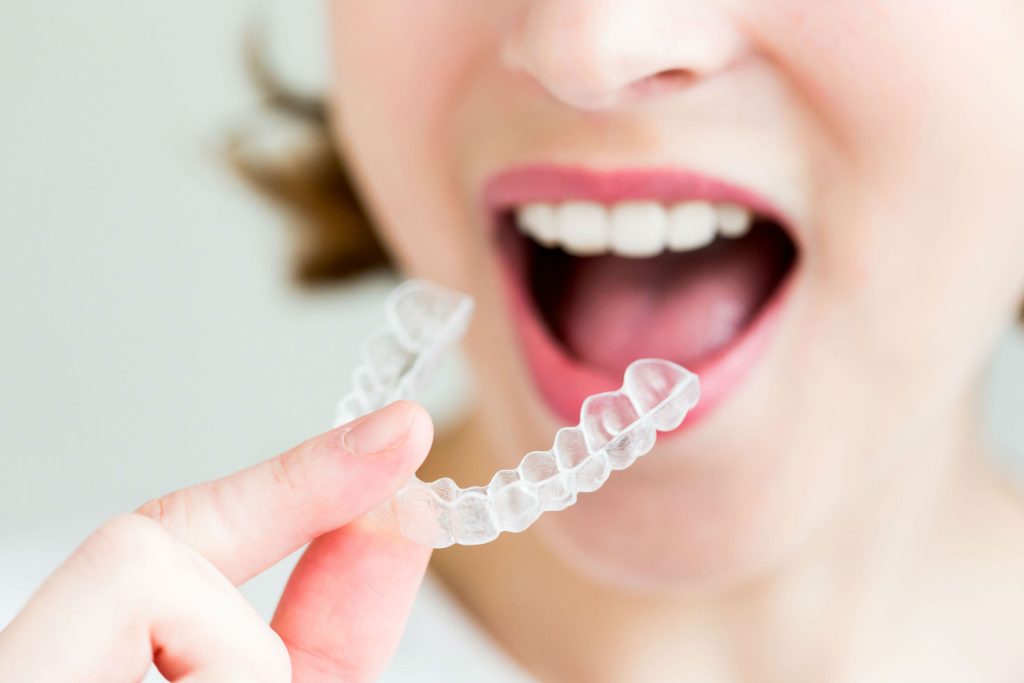 Invisalign