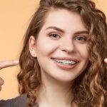 everything you need to know about traditional braces