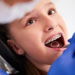 Why Early Orthodontic Care Is Important For Healthy Smiles