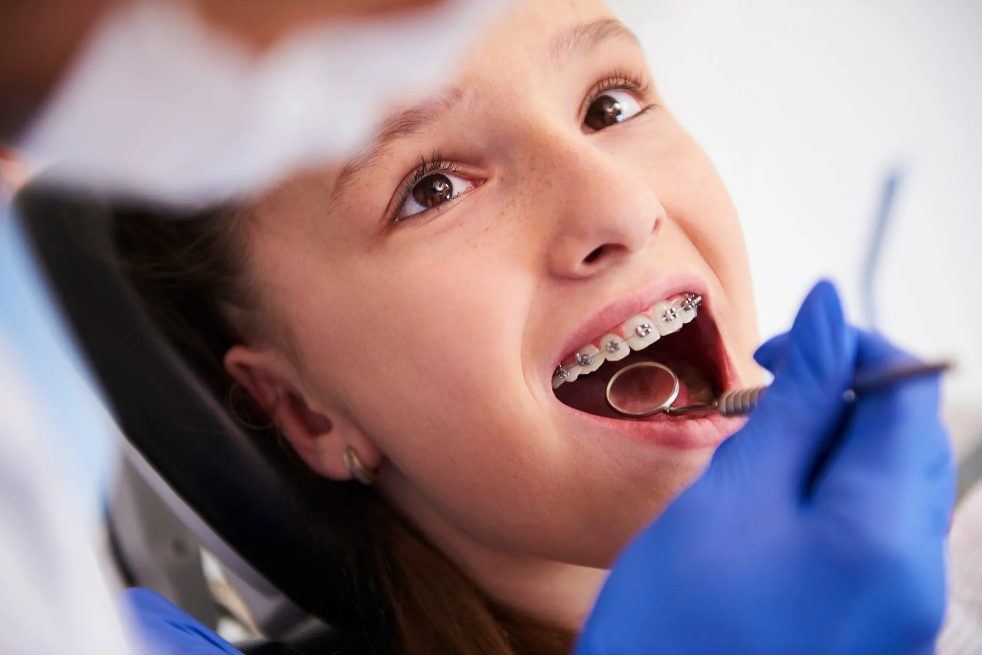 Why Early Orthodontic Care Is Important For Healthy Smiles